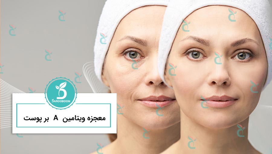 درمان پوست با ویتامین A